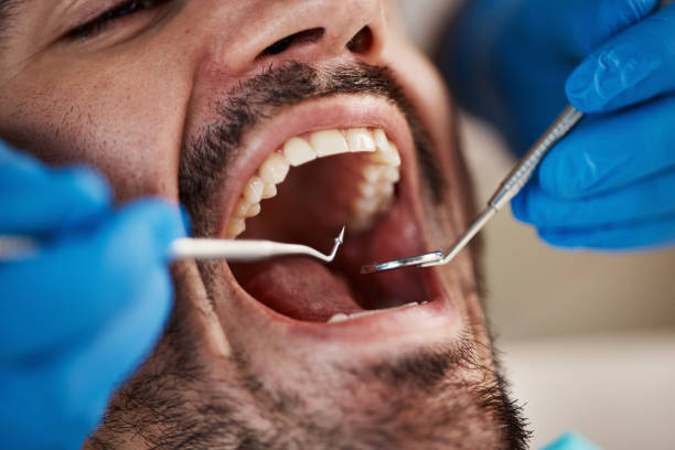 Best Emergency Dental Services for Seniors in Conestee, SC